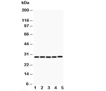 Anti-CD40L