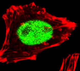 Anti-MGMT, clone 888CT22.2.4