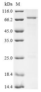 Fermitin family homolog 2 (FERMT2), human, recombinant