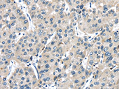 Anti-TRPM2