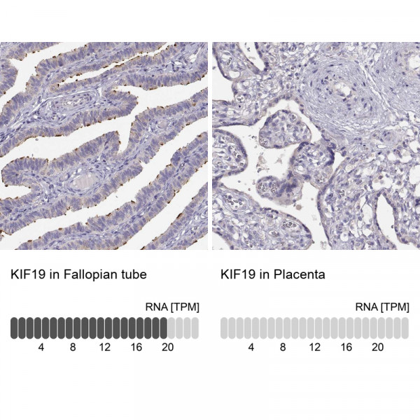 Anti-KIF19