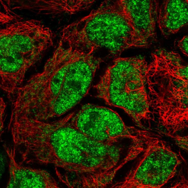 Anti-CDK5RAP1