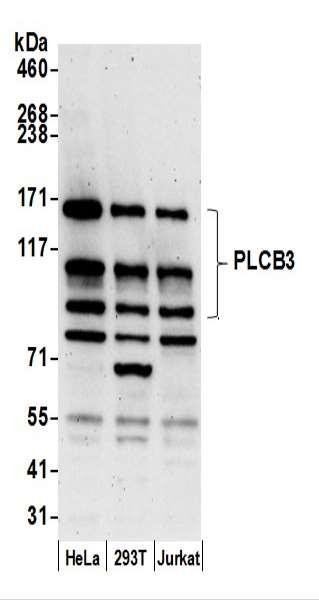 Anti-PLCB3