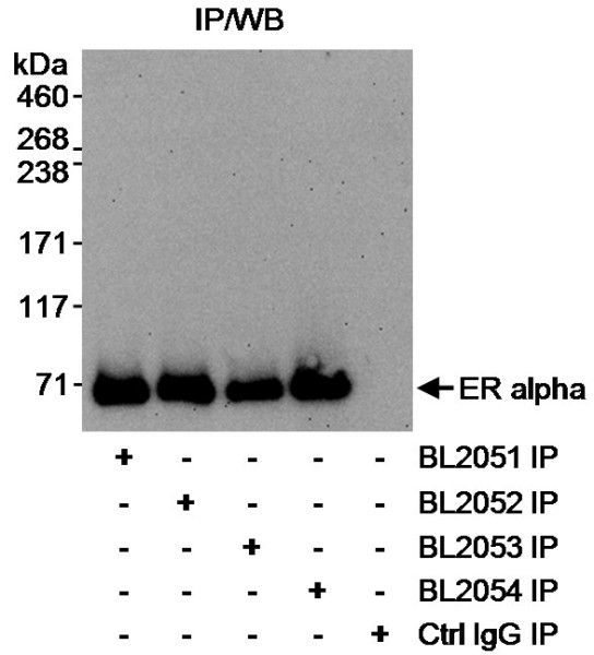 Anti-Estrogen Receptor Alpha