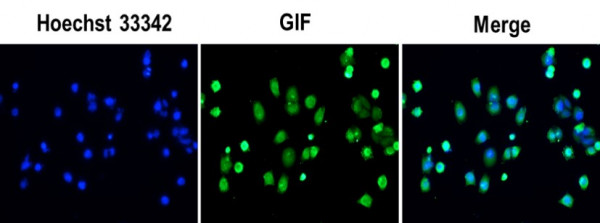 Anti-GIF / Gastric Intrinsic Factor, clone SQab18119