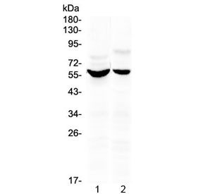 Anti-KPNA2 (N-Terminal Region)