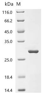 Diamine acetyltransferase 1(SAT1), partial, recombinant human