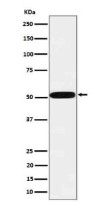 Anti-HTRA1 / HtrA serine peptidase 1, clone 31H06