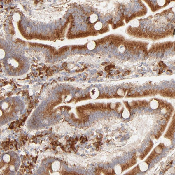 Anti-PARP12
