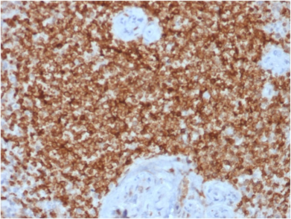 Anti-Bcl-2 (Apoptosis &amp; Follicular Lymphoma Marker), recombinant antibody, clone BCL2/1878R