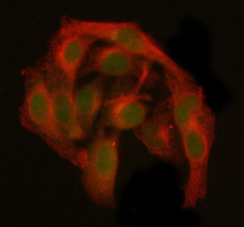 Anti-MCM3AP / Minichromosome maintenance complex-binding protein 3-associated protein