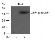 Anti-phospho-ATF4 (Ser245)