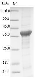 Renin receptor (ATP6AP2), human, recombinant