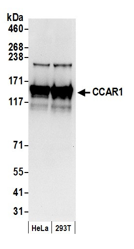 Anti-CCAR1