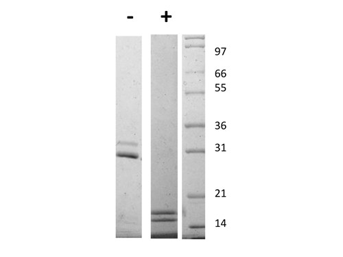 Interleukin-17AF Heterodimer
