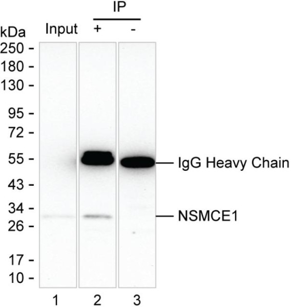 Anti-NSMCE1