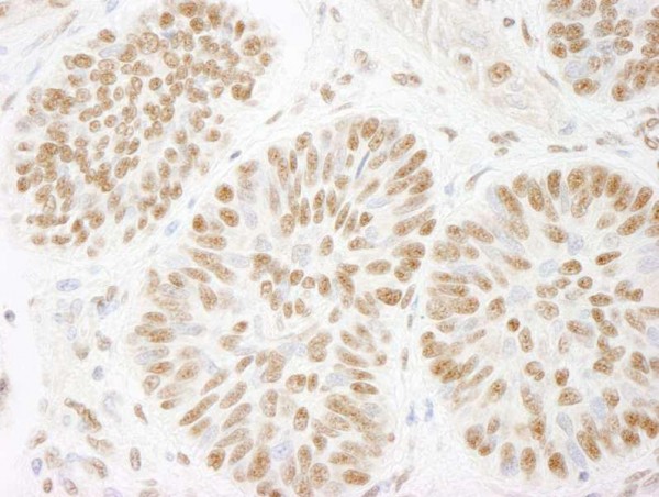 Anti-ACINUS/ACN1 (IHC)