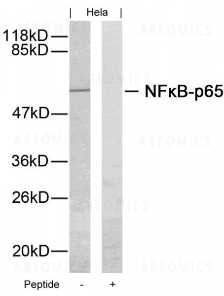 Anti-NFkB-p65 (Ab-276)