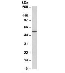 Anti-ALDH3A1