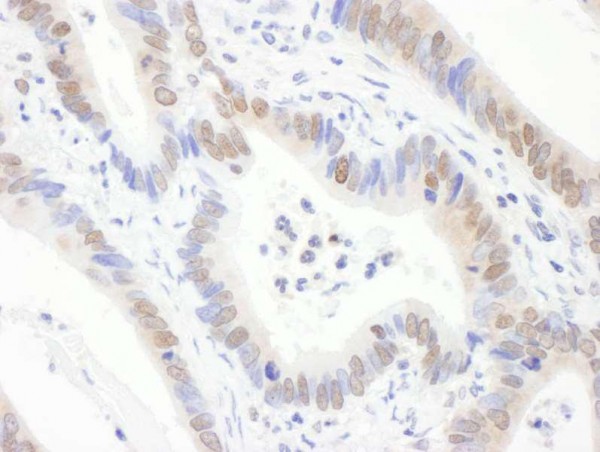 Anti-gamma-H2AX (IHC)