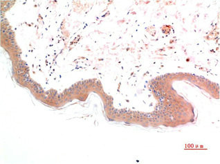 Anti-Phospho-SMAD3(S425) Monoclonal