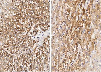 Anti-IL-1 beta/IL1B Monoclonal Antibody