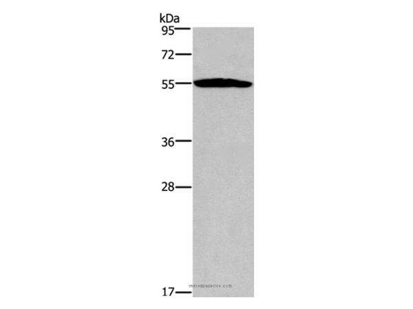 Anti-SERPINA1