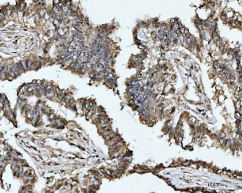 Anti-MAT2A / Methionine adenosyltransferase 2