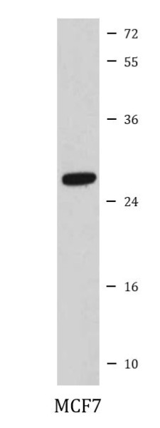 Anti-CDCA3