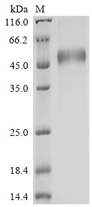 Advanced glycosylation end product-specific receptor (AGER), partial, human, recombinant