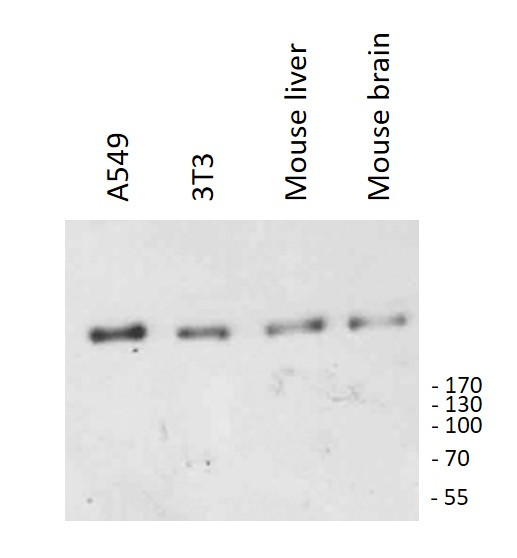 Anti-CD35 / CR1