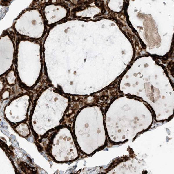 Anti-TRNAU1AP