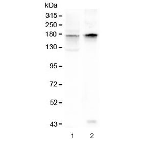 Anti-KCNH1