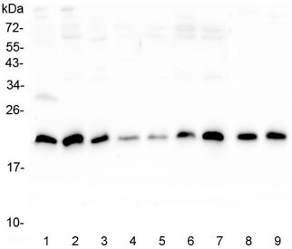 Anti-Sorcin / SRI