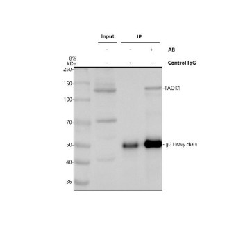 Anti-TAOK1 / TAO kinase 1