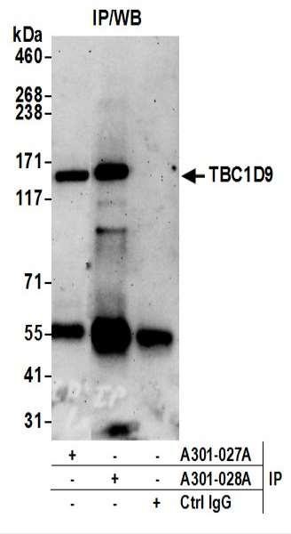 Anti-TBC1D9