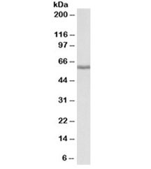 Anti-Fibrinogen beta chain