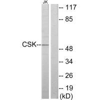 Anti-CSK