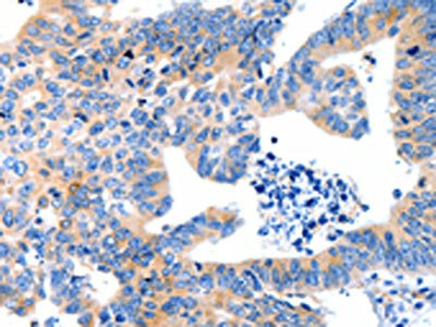 Anti-LRPAP1