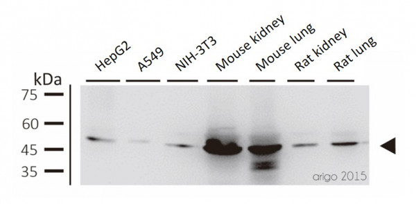 Anti-ALDH2