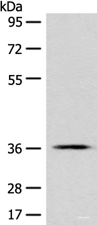 Anti-GPR55