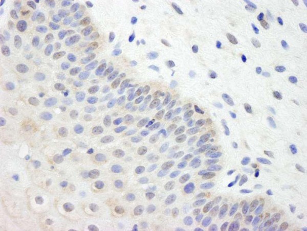 Anti-UBCH7 (IHC)