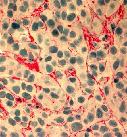 Anti-Fibronectin (EDA), mAb (blocking) (IST-9) (preservative free)
