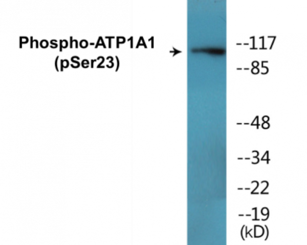 ATP1A1 (Phospho-Ser23) Colorimetric Cell-Based ELISA Kit