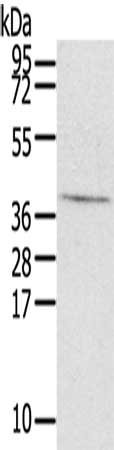 Anti-EFNB3