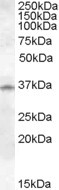 Anti-Cathepsin K, Internal (near N-term)