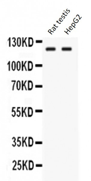 Anti-LRIG3