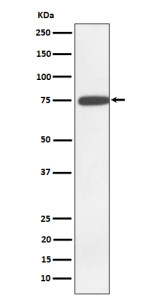 Anti-GNE / Glucosamine 6 phosphate N acetyltransferase, clone 29G96