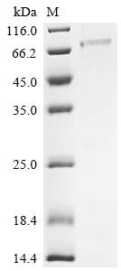 Protein mono-ADP-ribosyltransferase PARP10 (PARP10), partial, human, recombinant