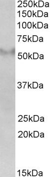 Anti-FSD1, Internal